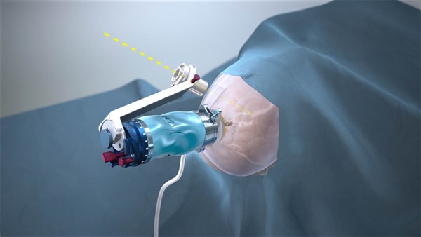 RenaissanceBrainAnimation